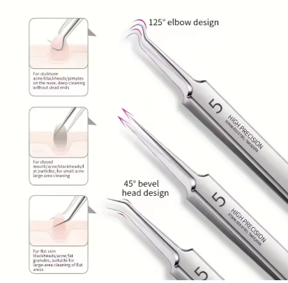 8-Piece Blackhead Remover Kit – Stainless Steel Blemish & Acne Extraction Tools
